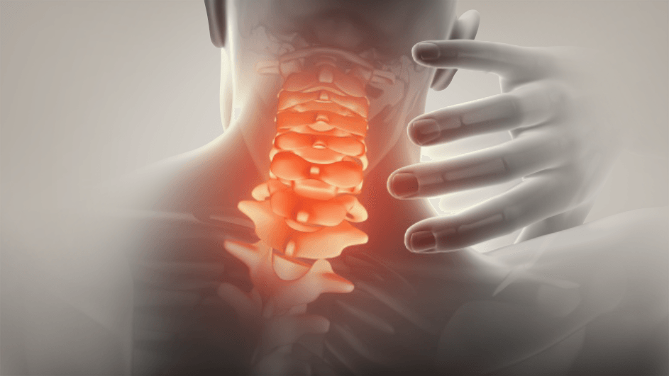 運動損傷に対する管理戦略